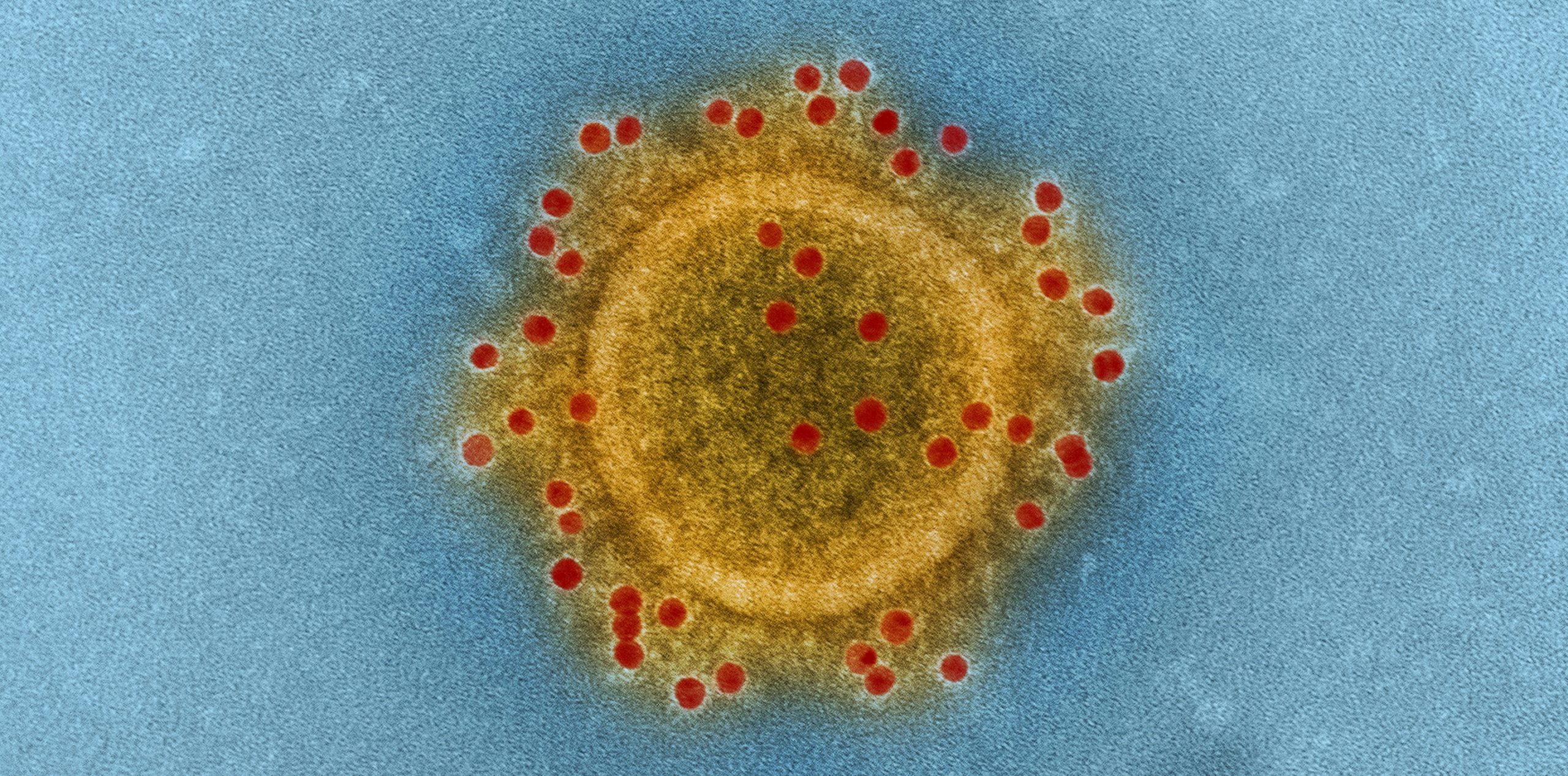 Coronavirus